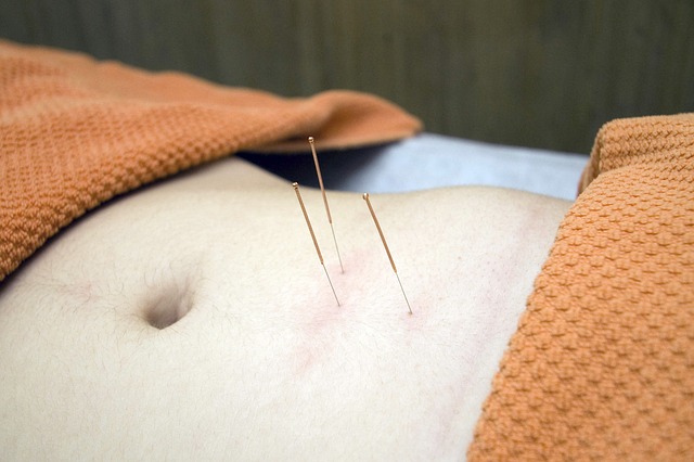 Akupunktur - drei Nadeln